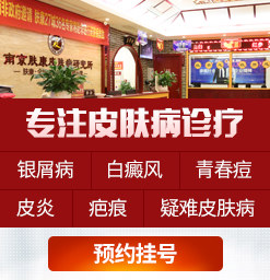 江苏省皮肤病研究院专家号难约吗？