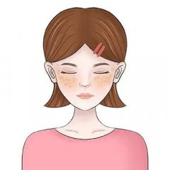 脸上的雀斑怎么去掉