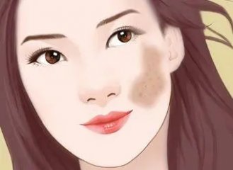 南京皮研所祛斑怎么样