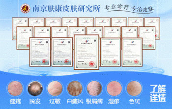 拍照自测皮肤病